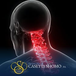 An illustration of a spinal cord injury caused by a car accident